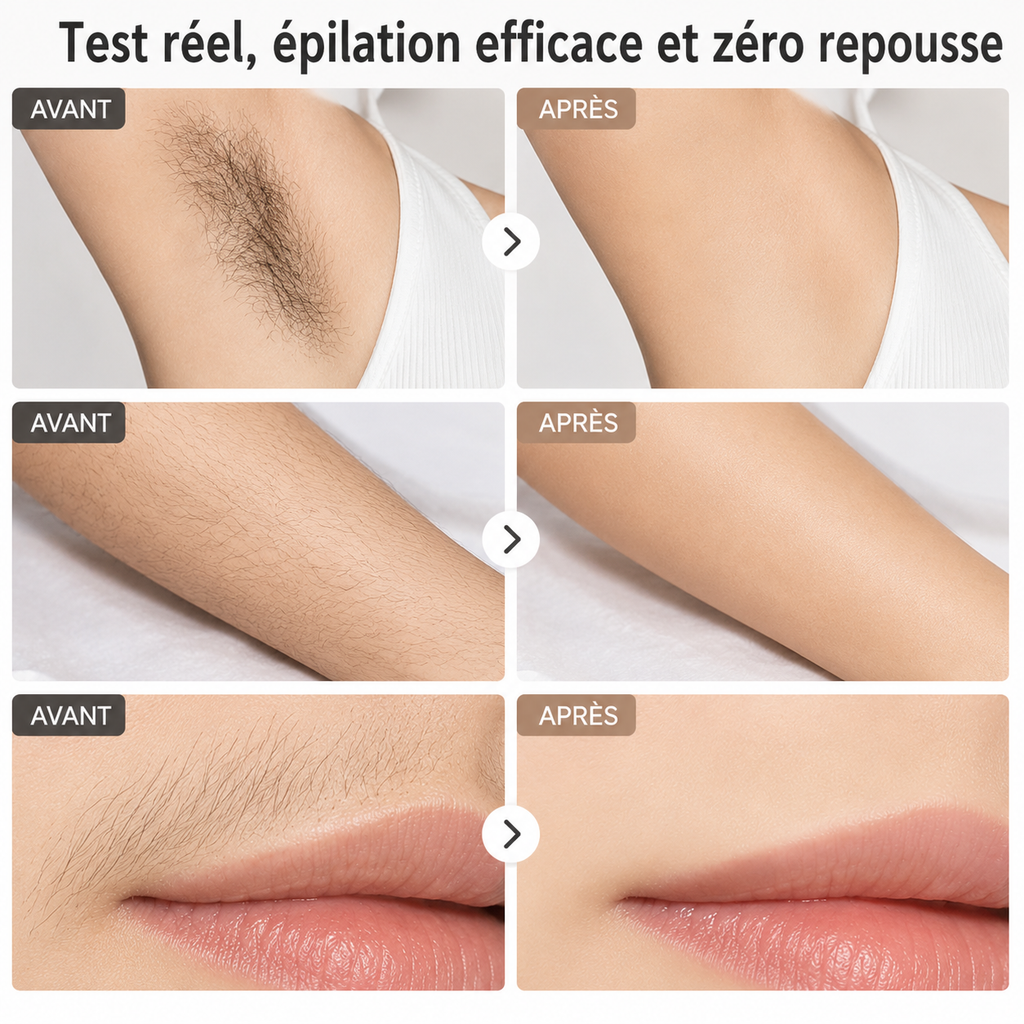 Portable Automatic Skin Recognition Function Painless Home Use Hair Removal Ipl Laser Epilator Hair Removal