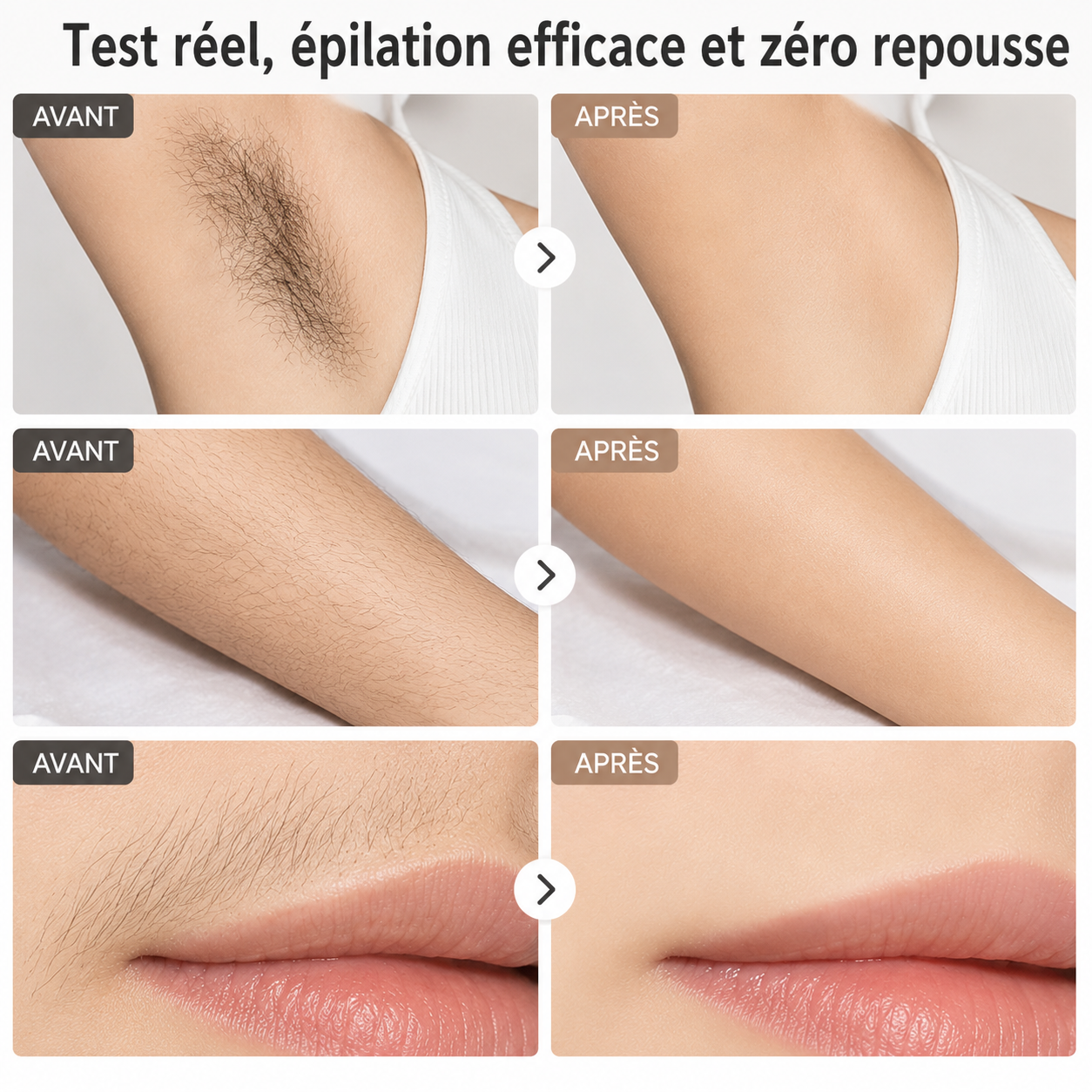 Portable Automatic Skin Recognition Function Painless Home Use Hair Removal Ipl Laser Epilator Hair Removal